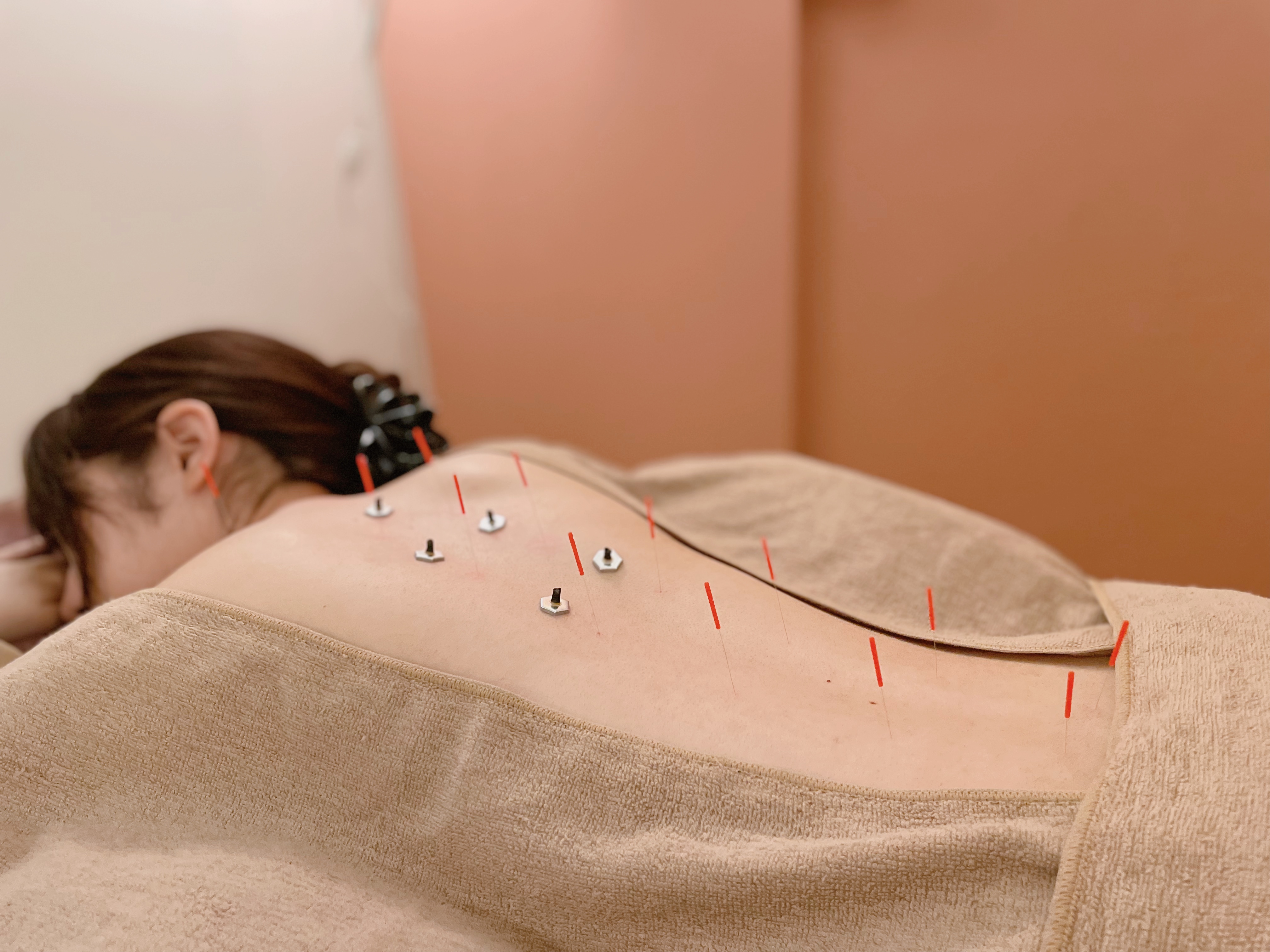 鍼灸鎌取ラフォンテ