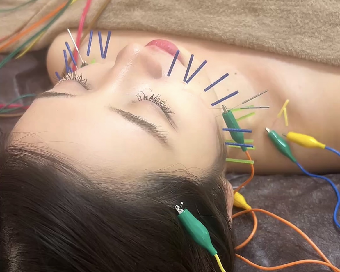 小顔特化美容鍼Lafonte